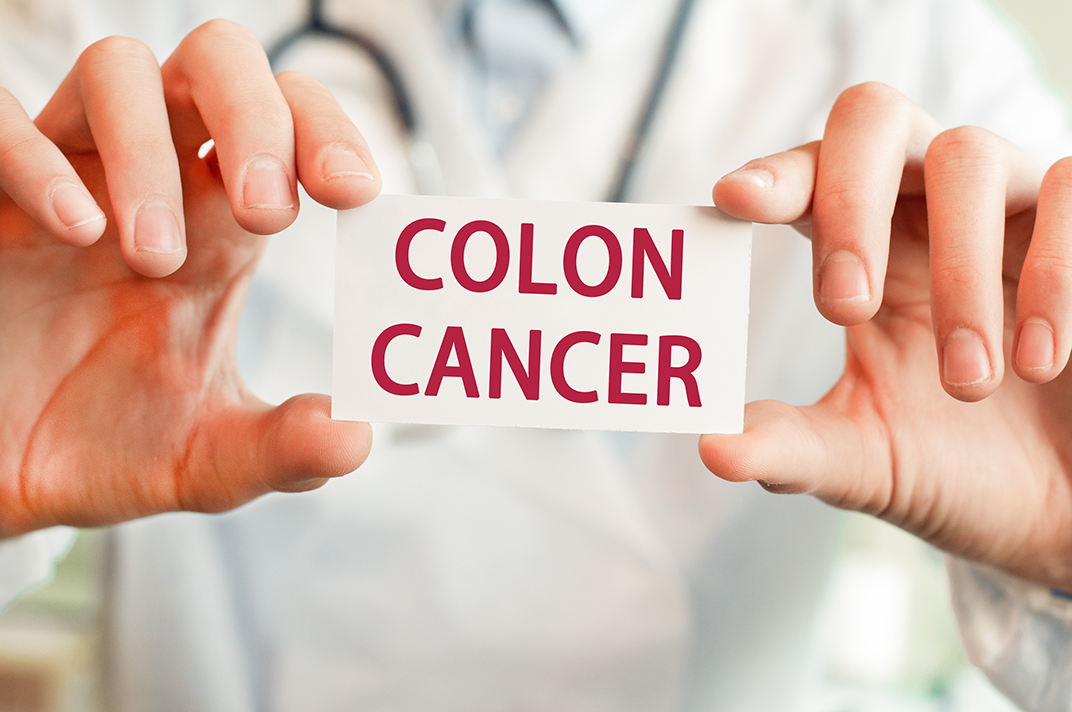 how-to-lower-your-risk-of-colon-cancer